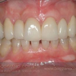 Denti e gengive