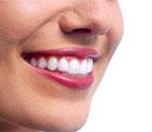 Invisalign� Apparecchio invisibile