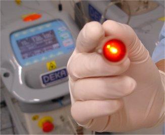 Il laser in odontoiatria